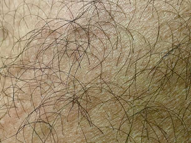 istock Hairs on human body 1317697403