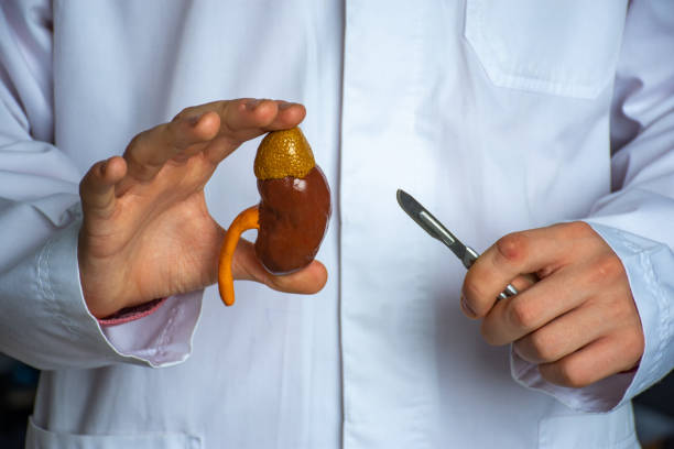 kidney and adrenal surgery medical surgical photo idea. the doctor holds in one hand a model of a kidney with a ureter, and in the other a scalpel, depicting a surgical operation to treat or remove - suprarenal gland imagens e fotografias de stock