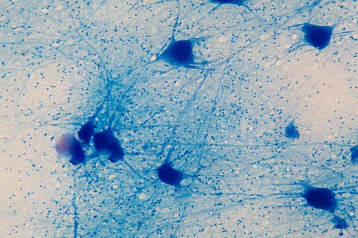 Motor Neuron cells under the microscope