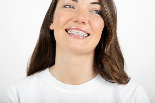 Young woman wearing braces