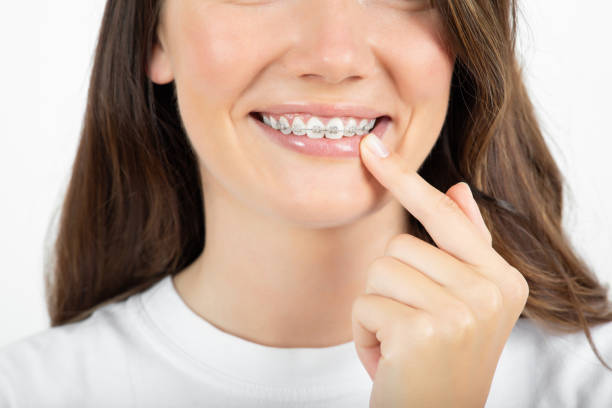 istock Beautiful young woman with braces 1317985716