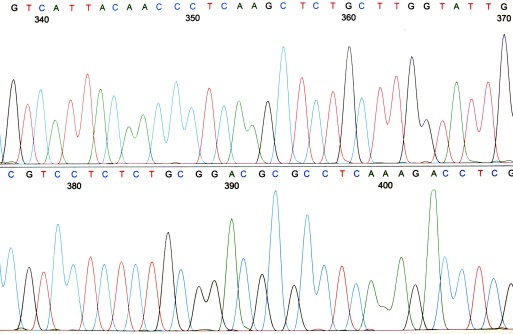 Chromatogram output from a DNA sequencer showing different coloured peaks that correspond to the four different nucleotides. Makes a great background for PowerPoint presentation for molecular biology, genetics, systematics or genomics lectures.