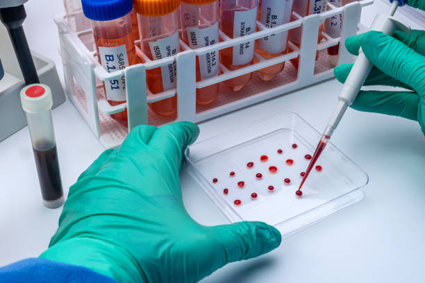 Laboratory analysis of a new Sars-Cov-2 mutation in Belgium from Congo, known as Spike Insertion (SI) whose scientific name is B.1.214, conceptual image Laboratory analysis of a new Sars-Cov-2 mutation in Belgium from Congo, known as Spike Insertion (SI) whose scientific name is B.1.214, conceptual image antibody test stock pictures, royalty-free photos & images