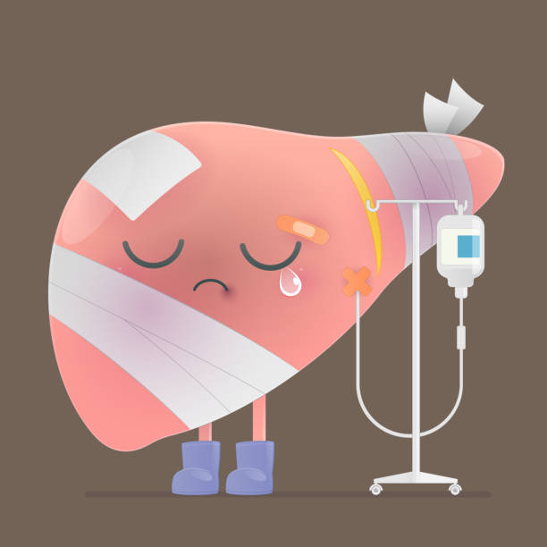 484 Cartoon Of A Cirrhosis Liver Illustrations & Clip Art - iStock