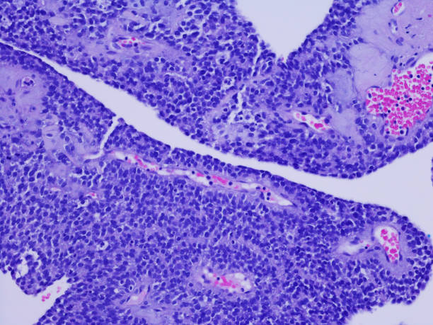 tumor de células de granulosa juvenil - ovary human cell cell high scale magnification fotografías e imágenes de stock