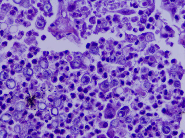 blastomykoza: zakażenie grzybicze - fungus pathogen scientific micrograph high scale magnification zdjęcia i obrazy z banku zdjęć