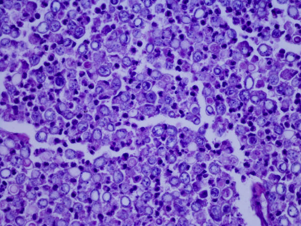 blastomykoza: zakażenie grzybicze - fungus pathogen scientific micrograph high scale magnification zdjęcia i obrazy z banku zdjęć