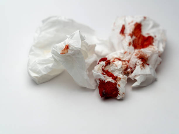 istock fresh red blood stained on tissue paper isolated on white background 1318290924