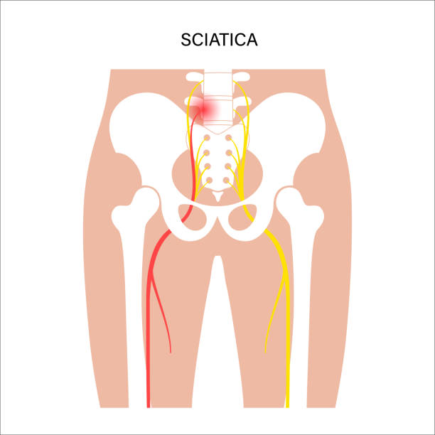 근육 골반 - hip femur ilium pelvis stock illustrations