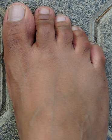 Foot is ugly, dark brown and it has hair and veins showing. No manicure. unmanicured nails.