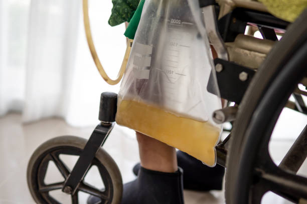 patient asiatique de femme de dame s’asseyant sur le fauteuil roulant avec le sac d’urine dans le service d’hôpital, concept médical sain - foley photos et images de collection