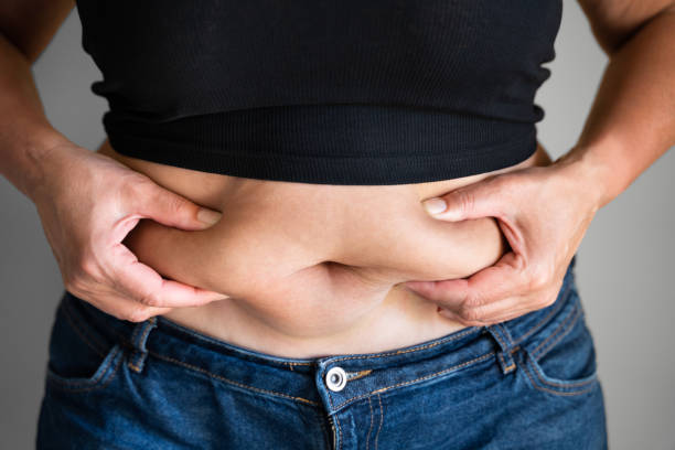 istock Fat Button Belly And Body 1318461662