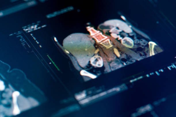 istock Human Spine and Pelvis MRI Scan 1318472783