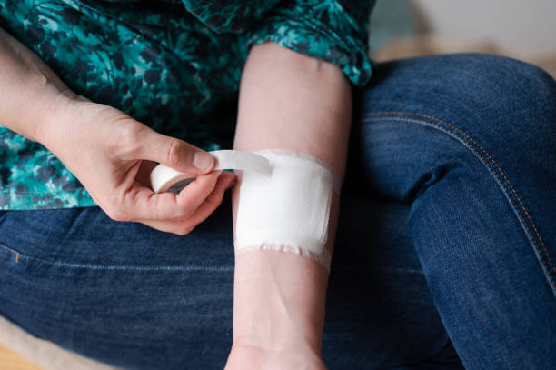 mujer pone gasa estéril en antebrazo lesionado - gauze fotografías e imágenes de stock