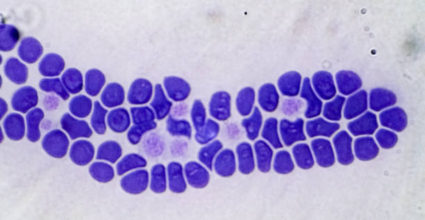 Mutant Blood Color 210+ Mutant Hemoglobins Stock Photos, Pictures & Royalty-Free Images ...