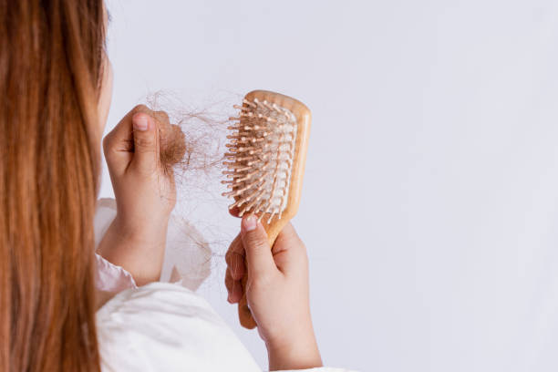 istock Closeup hand holding comb and hair fall problem isolated grey background. 1318560222