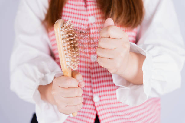 istock Closeup hand holding comb and hair fall problem isolated grey background. 1318560229