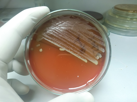 Bacteria Staphylococcus aureus on the surface of blood agar medium at medical microbiology laboratory.