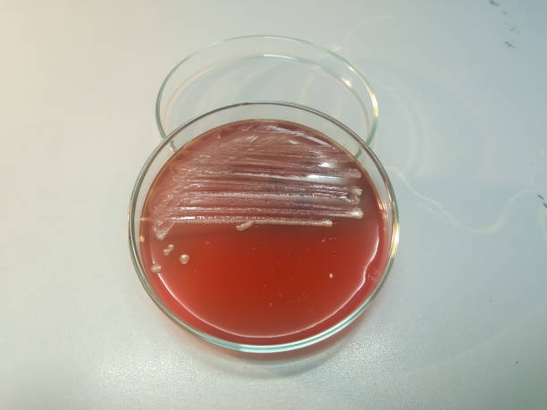 staphylococcus aureus su mezzo di agar del sangue - mrsa blood agar surgical glove microbiology foto e immagini stock