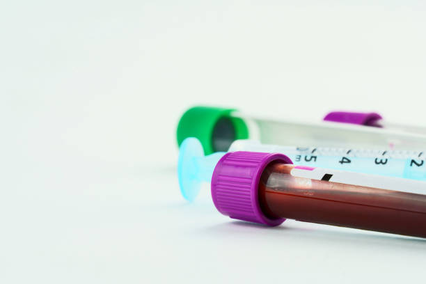 istock Vacuum tubes for collection and blood samples and a syringe on white background. Transparent tubes with purple and green lid. Label to identify the data. Selective focus 1318689243