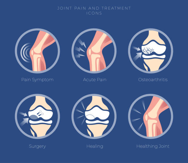 Set of icons of the joints and their treatment Cartilage damage, arthritis, osteoarthritis, restoration of cartilage, joints pain. Medicine icon set. osteoarthritis stock illustrations