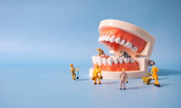 istock Selective focus miniature workers clean and correct the tooth model on a blue background. Dental examination concept.Regular oral health is vital to oral health. 1318756264