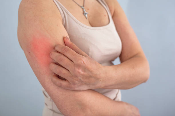 istock Women scratch the itch with hand 1318776712