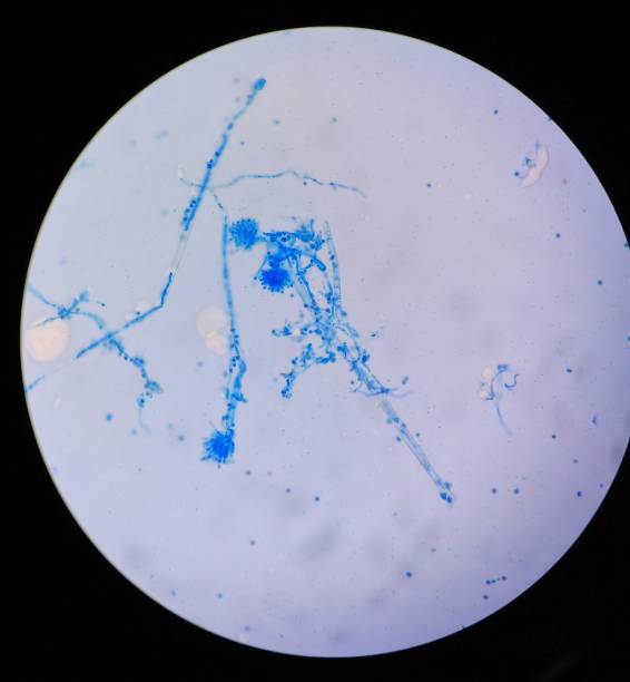 istock A view of stained Fungus through a Microscope 1318878903