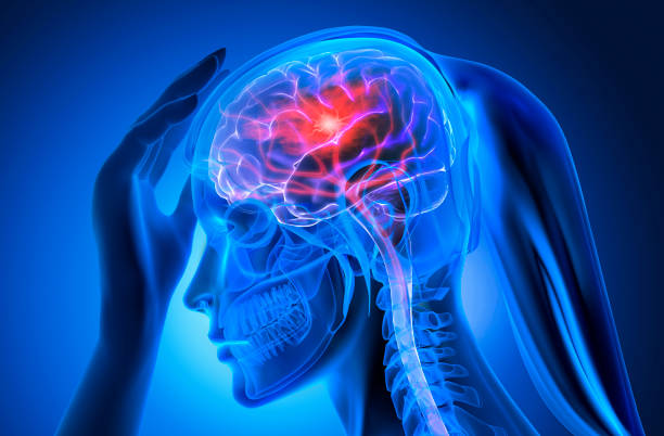 istock Woman with brain stroke 1318896340