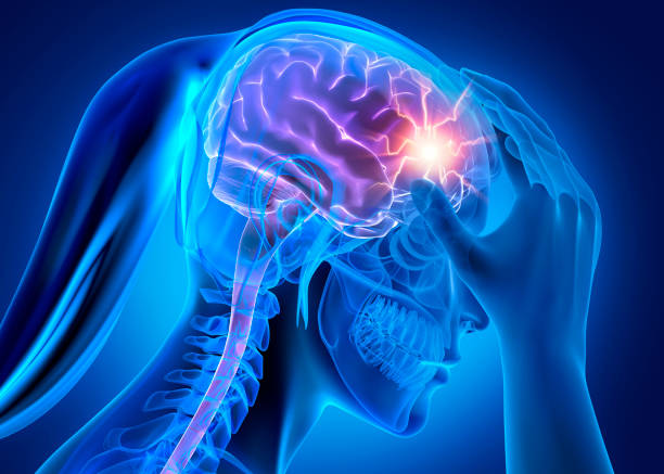 istock Woman with heavy headache 1318896359