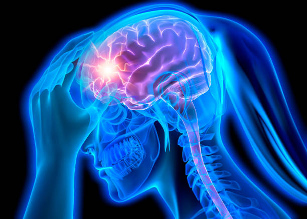 istock Woman with heavy headache 1318896381