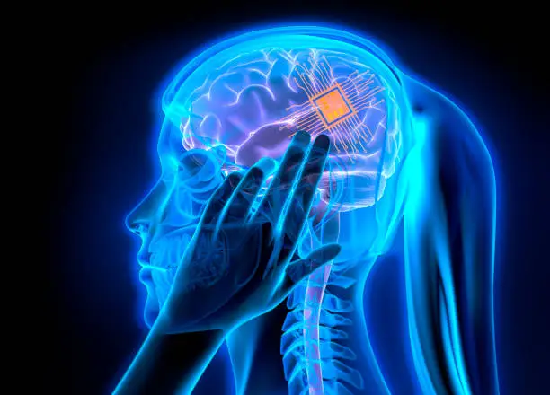 Woman with electronic micro chip brain implant - dark blue background - 3D illustration