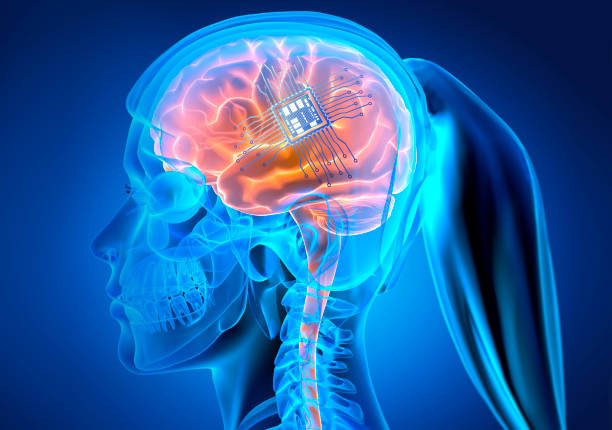 istock Woman with brain implant 1318898756