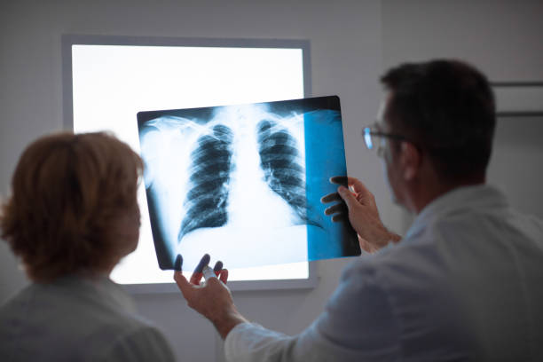 istock Radilogists looking at lung x-ray against negatoscope light 1319007761