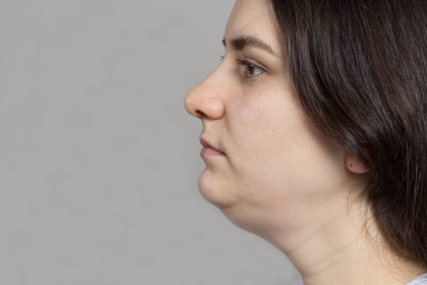 The woman has a double chin. Treatment, chin reshaping, fat removal, lifting. Place for text copy space drooping photos stock pictures, royalty-free photos & images