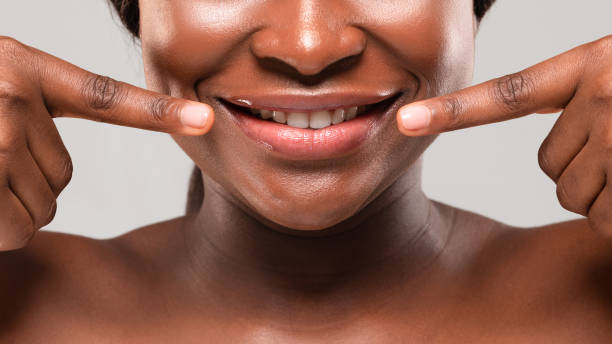istock Lip Augmentation Concept. Young African Female Pointing At Her Beautiful Smile, Closeup 1319037624