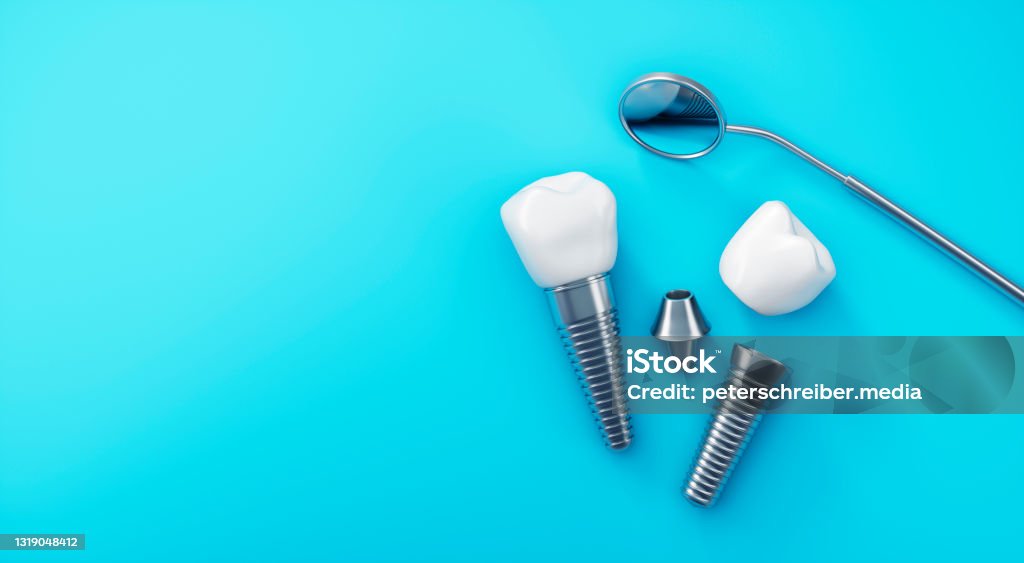 Dental implants isolated on blue background Dental implants isolated on blue background with copy space Dental Implant Stock Photo