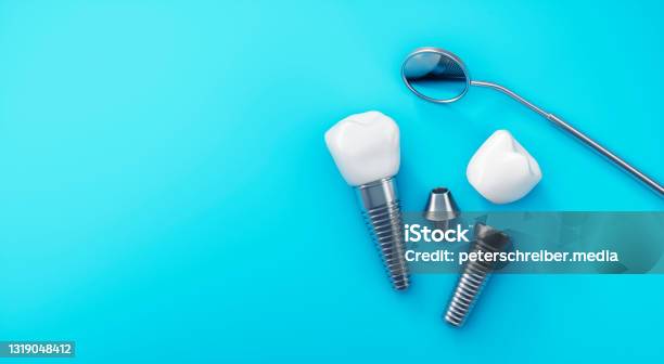 Dental Implants Isolated On Blue Background Stock Photo - Download Image Now - Dental Implant, Implant, Dental Health