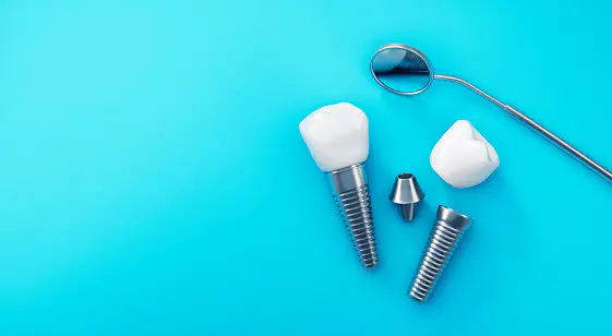 Tulsa dental Implants
