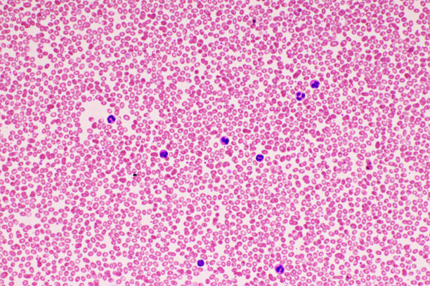 혈액 얼룩의 적혈구 - blood cell red blood cell blood cell 뉴스 사진 이미지