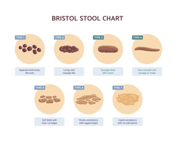 wykres stolca bristolskiego z opisem leków ludzkich ekskrementów. - stool stock illustrations