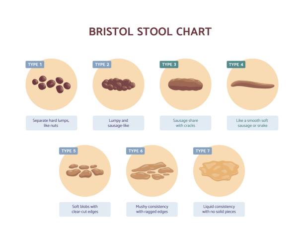 Bristol stool chart with medicine description of human excrements. Bristol stool chart with medicine description of human excrement at health stomach and diseases of digestion. Vector illustration. stool stock illustrations