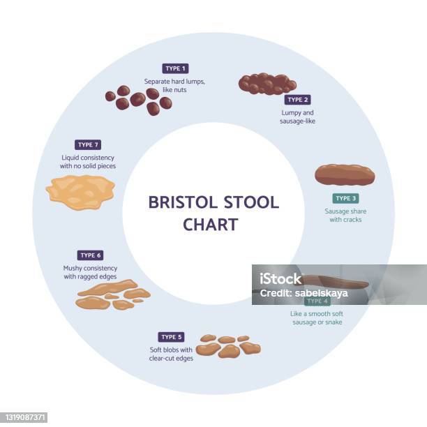 Bristol Stool Chart Infographic Flat Vector Illustration Isolated On ...