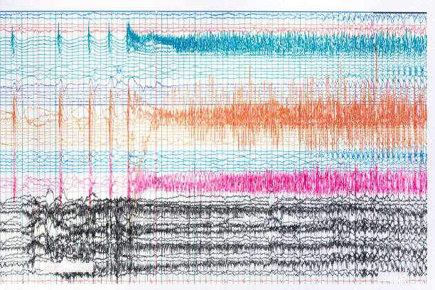 Photograph of brain waves during seizure Photograph of ictal EEG recording during seizure. Seizure waves showing propagation of high amplitudes and frequency waves. eeg stock pictures, royalty-free photos & images