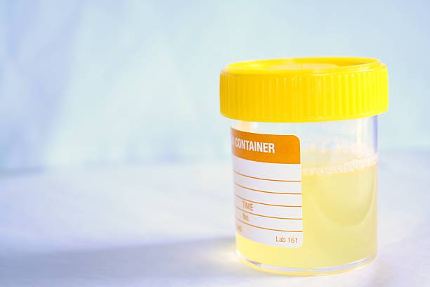 Urine sample stock photo