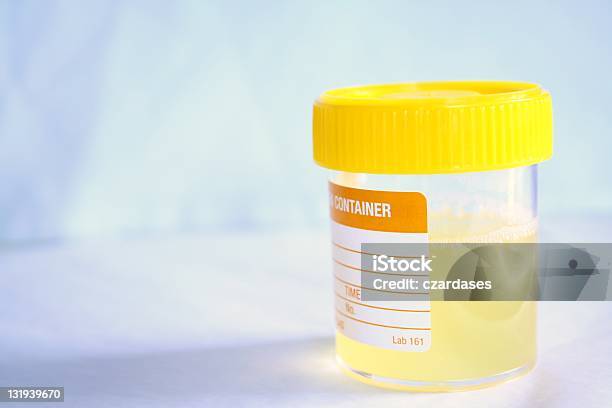 Urine Sample Stock Photo - Download Image Now - Urine, Urinary Tract Infection, Overcast