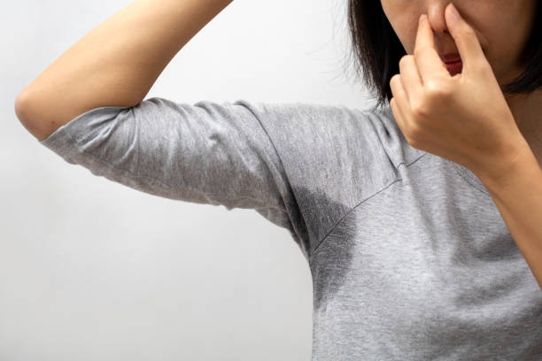 Close-up Asian woman with hyperhidrosis sweating. stock photo