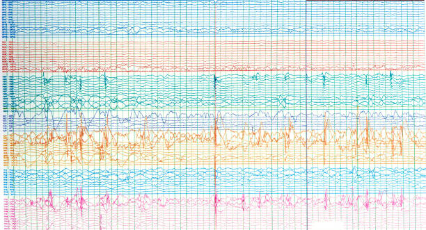 fotografia di onde cerebrali del paziente con epilessia - eeg foto e immagini stock