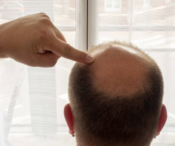istock man who shows his skull 1319756736