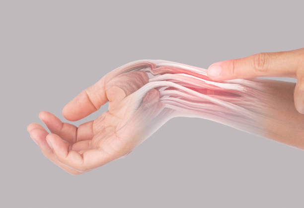 istock x-ray wrist muscle pain 1319773400
